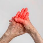 Mãos de pessoa idosa com vermelhidão e inflamação nas articulações, representando doenças reumáticas e dores articulares comuns.